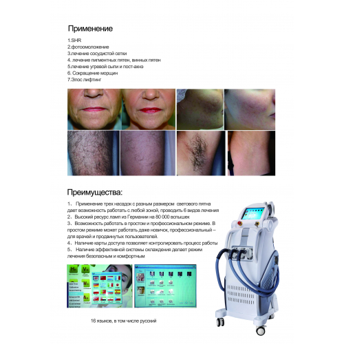 Косметологический аппарат "ЭЛОС KES MED 140C+"